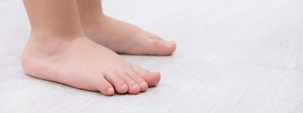 piede-piatto-del-bambino